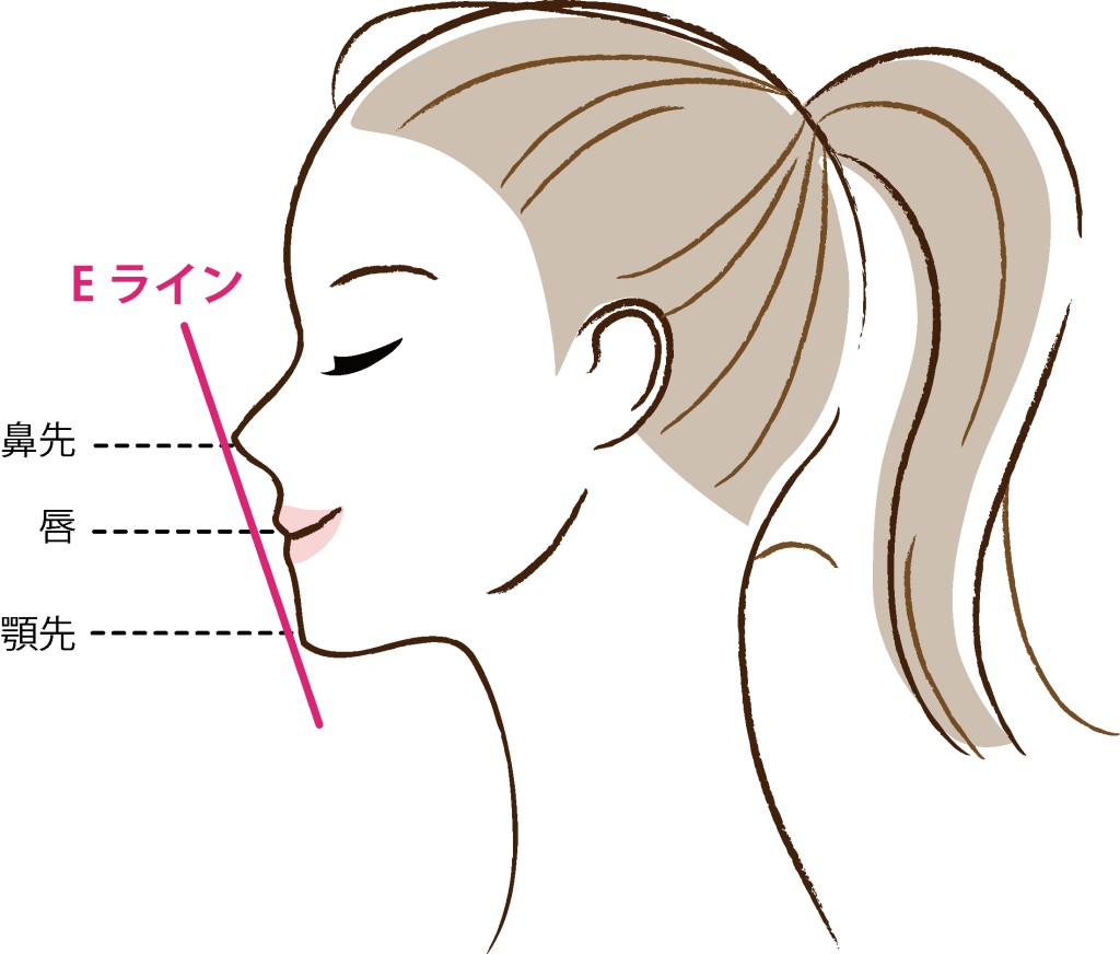 歯科矯正によりEラインが綺麗にできる