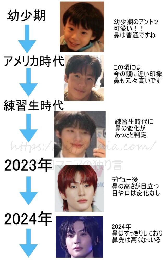 アントンの幼少期から2024年までの顔の変化