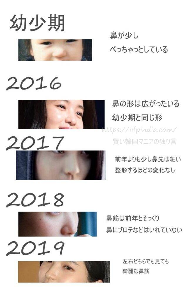 キムテリの2019年までの鼻の変化