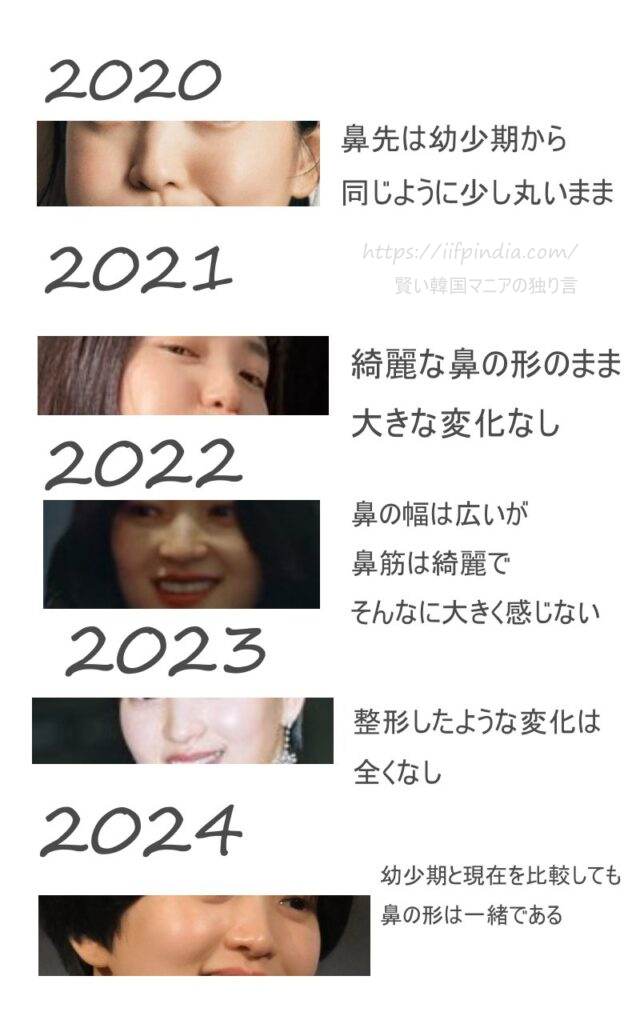 2020年から2024年までのキムテリの鼻の変化