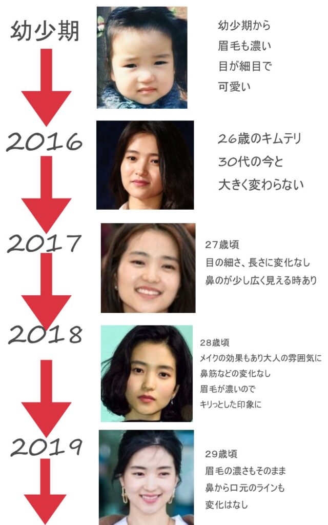 キムテリ整形疑惑の年表