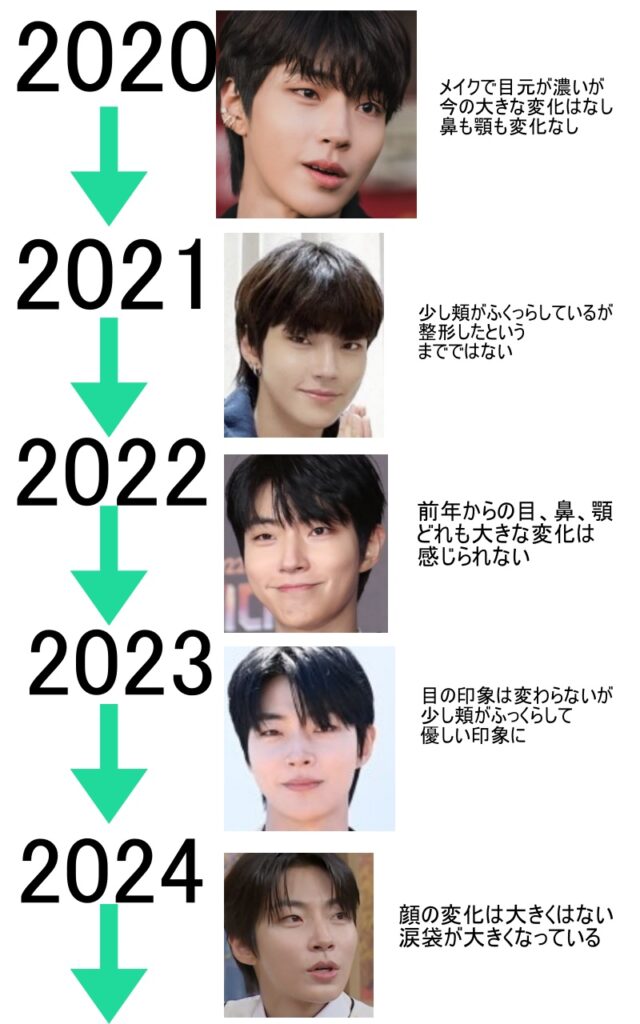 2020年から2024年までのファンイニョプの顔の変化